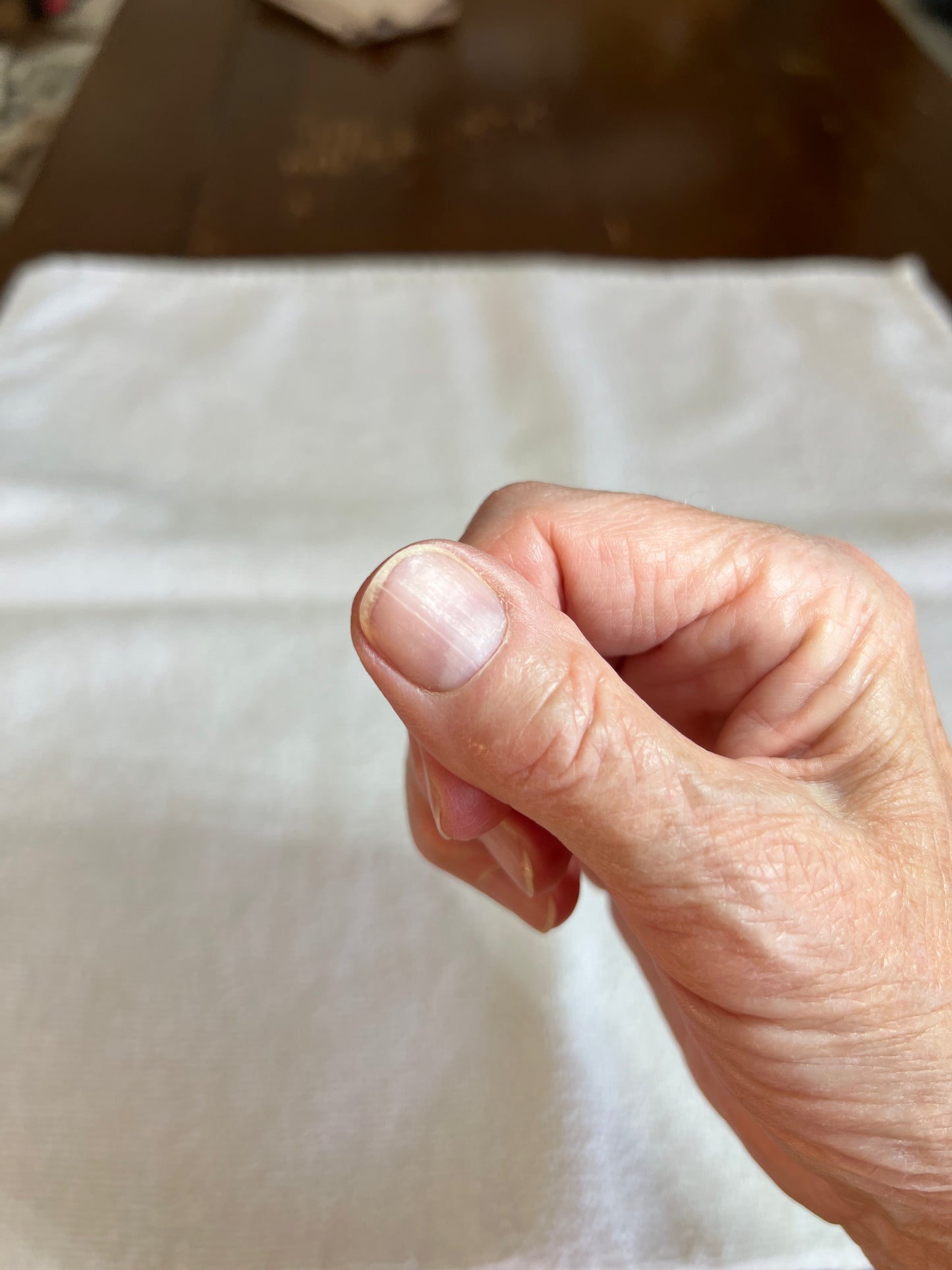 Anna's Professional Nail Assessment